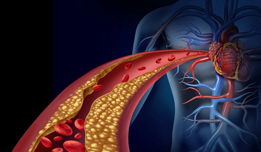 Persona controlando el colesterol alto para prevenir enfermedades cardiovasculares.